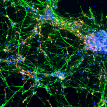 Human iPSC-derived neuronal cells (stained for β-III-Tubulin) after 21 days of differentiation