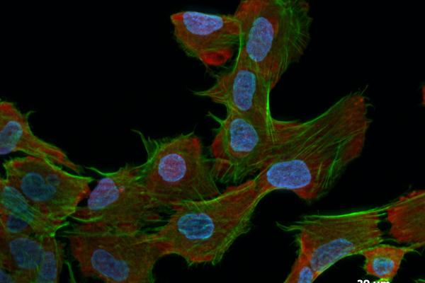 sio2-rubpy_nps_in_vitro-fluorescent_silica_nanoparticles_in_living_lung_epithelial_cells.jpg